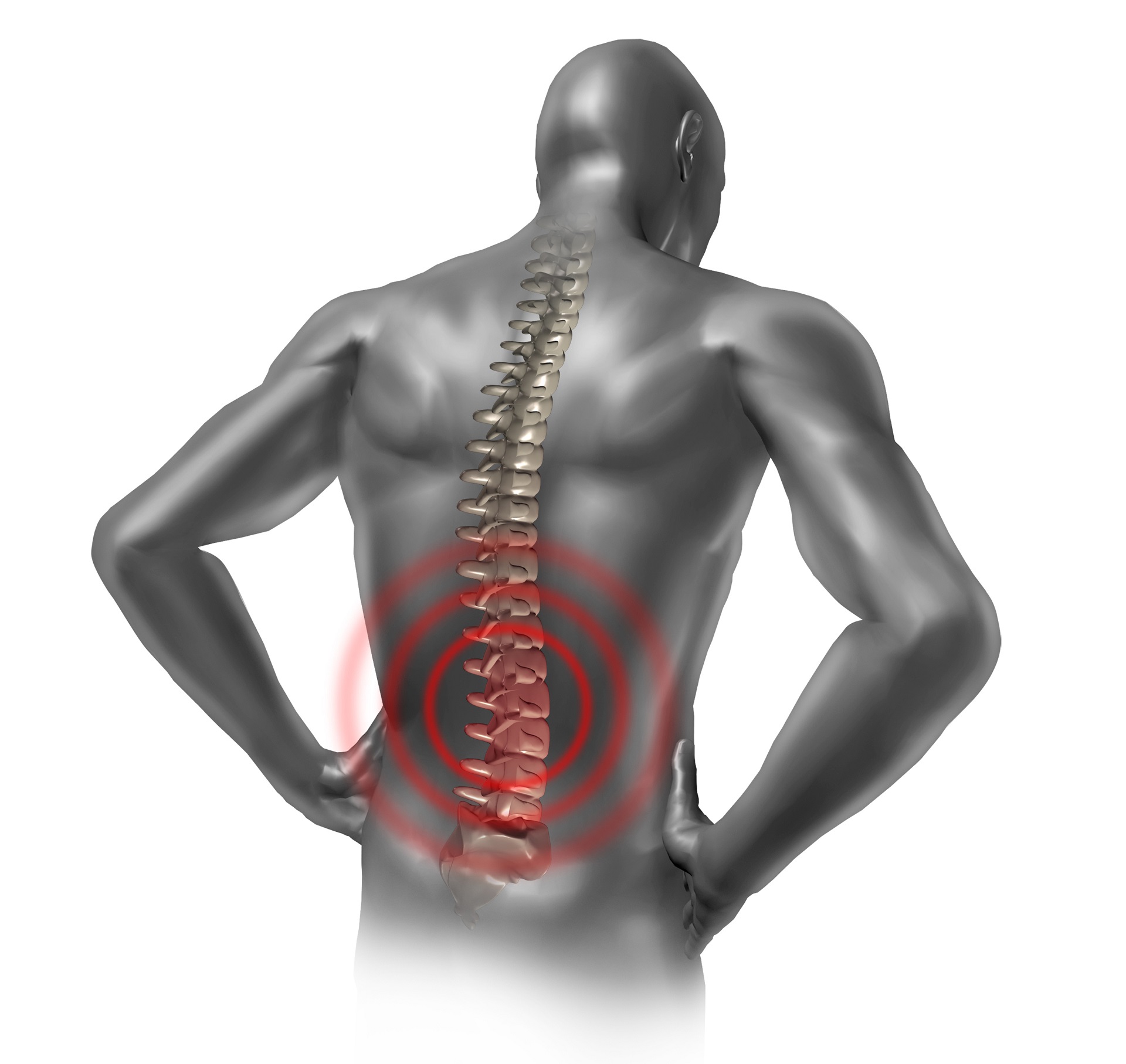 Back Pain | LA Pain Doctor